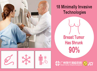 breast cancer, treatment for breast cancer,Modern Cancer Hospital Guangzhou