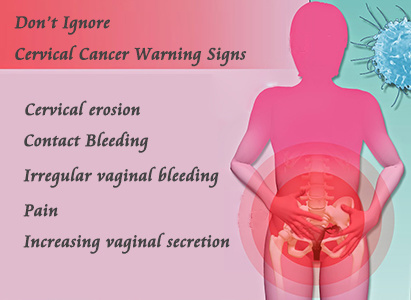 Cervical of warning cancer signs Cervical Cancer