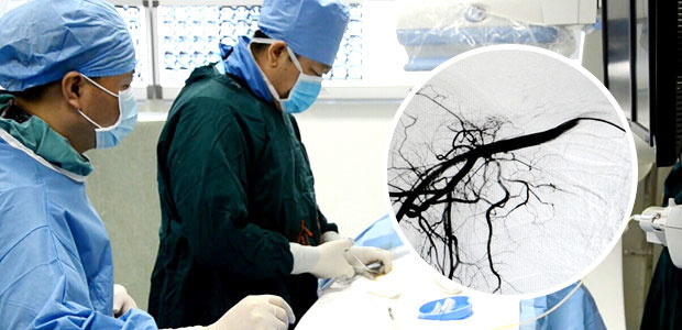 Lung cancer,interventional therapy,cryotherapy,biological immunotherapy