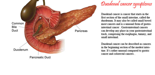duodenal cancer, treatment of duodenal cancer， duodenal cancer symptoms, duodenal cancer diagnosis