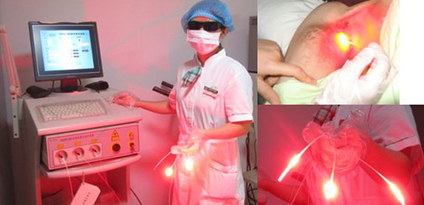 Photodynamic therapy (PDT)，Photodynamic therapy (PDT) for ca